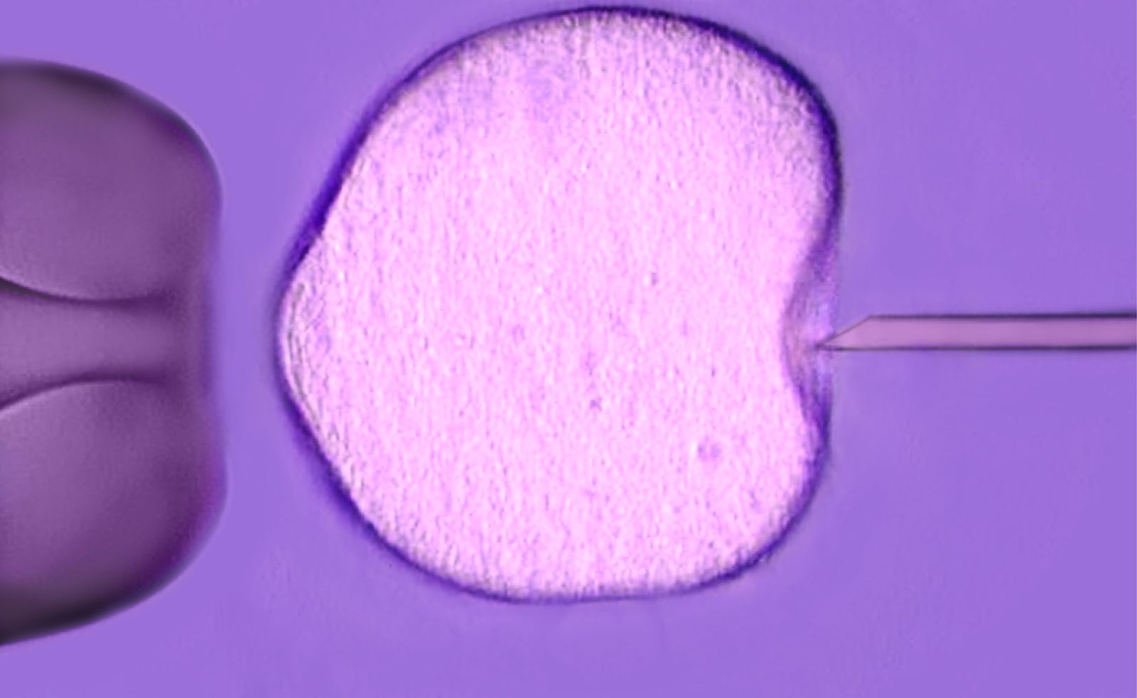 Microscopic view of an in-vitro fertilization (IVF) procedure, showing a needle injecting genetic material into an egg cell.