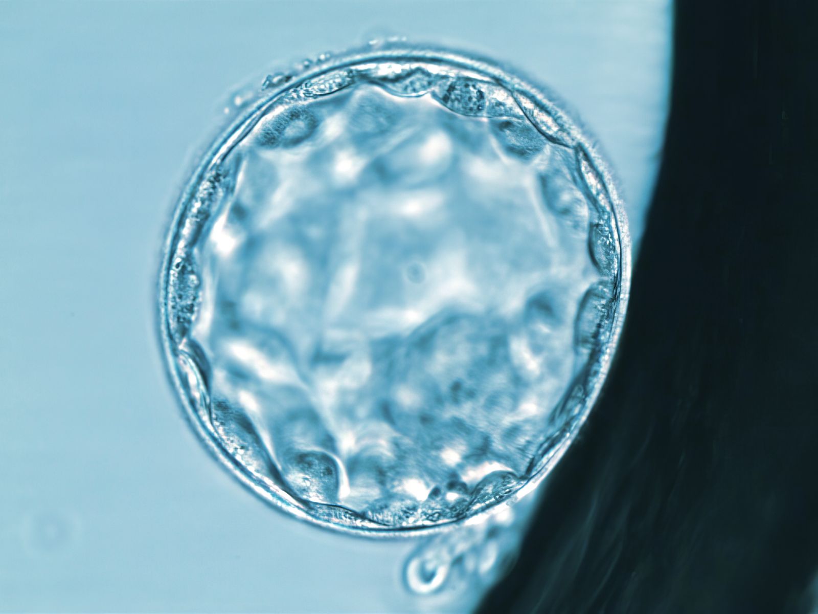 Microscopic image of a human blastocyst, showcasing an early stage of embryo development used in fertility treatments.